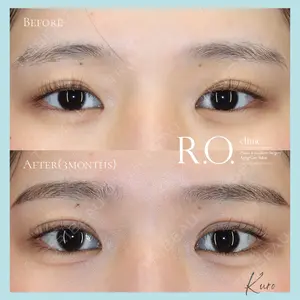 R.O.clinic 黒田 大樹医師の症例