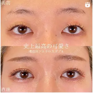 SOL CLINIC 向井 英子医師の症例