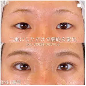 SOL CLINIC 向井 英子医師の症例