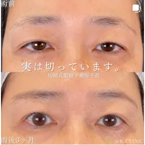 SOL CLINIC 向井 英子医師の症例