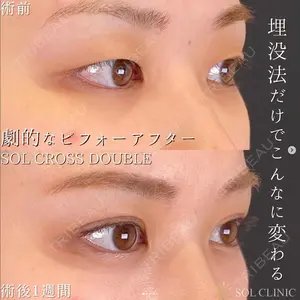 SOL CLINIC 向井 英子医師の症例