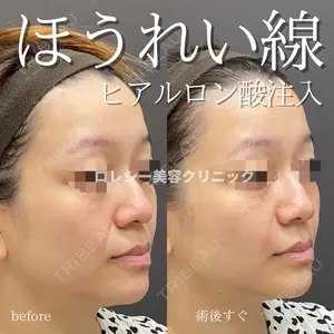ロレシー美容クリニック 心斎橋駅前院 高田先生医師の症例