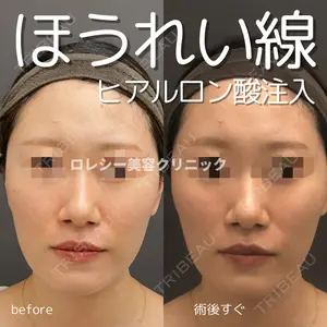 ロレシー美容クリニック 心斎橋駅前院 田中先生医師の症例