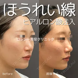 ロレシー美容クリニック 心斎橋駅前院 田中先生医師の症例