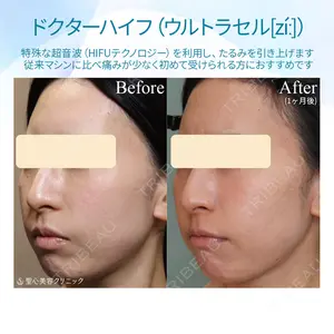 聖心美容クリニック 札幌院の症例