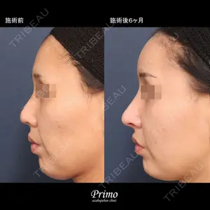 プリモ麻布十番クリニック 大場教弘医師の症例