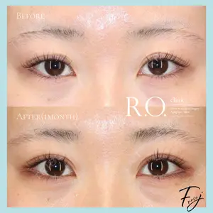 R.O.clinicの症例