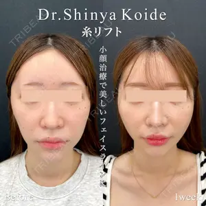 東京シンデレラ美容外科 池袋院の症例