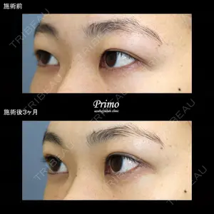 プリモ麻布十番クリニック 大場教弘医師の症例