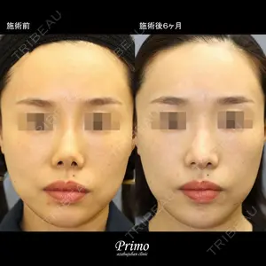 プリモ麻布十番クリニック 大場教弘医師の症例