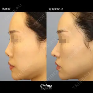 プリモ麻布十番クリニック 大場教弘医師の症例