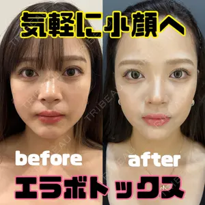 HAAB×DREAM BEAUTY CLINIC 東京本院 田中 優太医師の症例