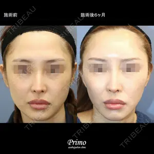 プリモ麻布十番クリニック 大場教弘医師の症例