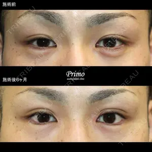 プリモ麻布十番クリニック 大場教弘医師の症例