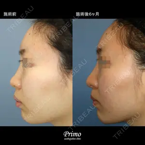 プリモ麻布十番クリニック 大場教弘医師の症例