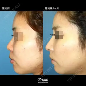 プリモ麻布十番クリニック 大場教弘医師の症例