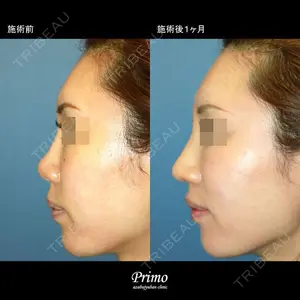 プリモ麻布十番クリニック 大場教弘医師の症例
