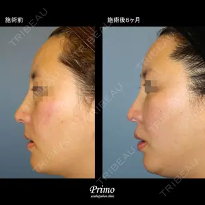 プリモ麻布十番クリニック 大場教弘医師の症例