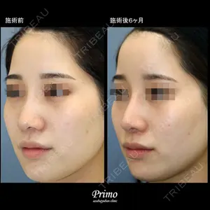 プリモ麻布十番クリニック 大場教弘医師の症例