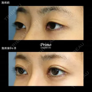 プリモ麻布十番クリニック 大場教弘医師の症例