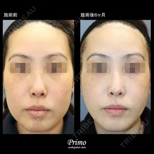 プリモ麻布十番クリニック 大場教弘医師の症例