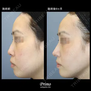 プリモ麻布十番クリニック 大場教弘医師の症例