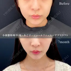 東京シンデレラ美容外科 池袋院の症例