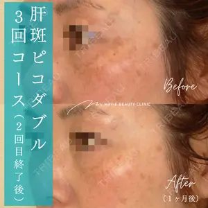 Mavie Beauty Clinic （マヴィービューティークリニック）の症例