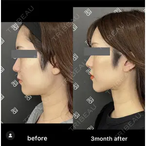 EMMO FACE CLINIC 大阪梅田院の症例