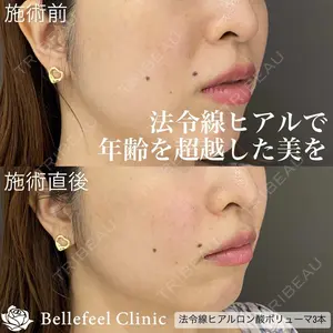 Bellefeel Clinic 代官山 兵藤 秀忠 医師の症例