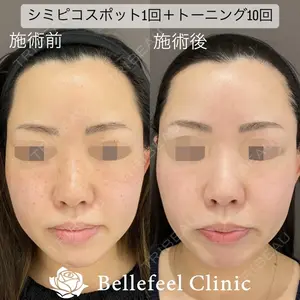 Bellefeel Clinic 代官山 兵藤 秀忠 医師の症例