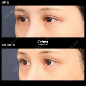プリモ麻布十番クリニック 大場教弘医師の症例