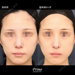 プリモ麻布十番クリニック 大場教弘医師の症例