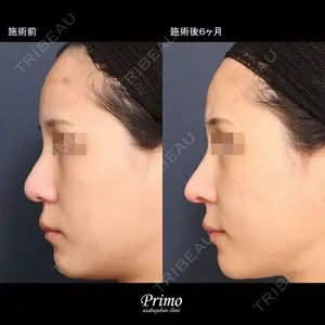 プリモ麻布十番クリニック 大場教弘医師の症例