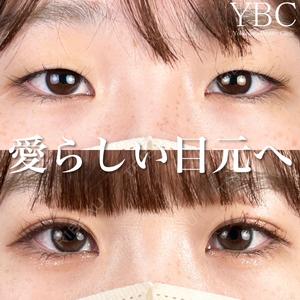 YBC横浜美容外科 池袋院 磯村 亮輔医師の症例