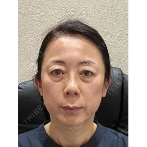 お茶の水美容形成クリニックの症例