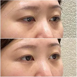 お茶の水美容形成クリニックの症例