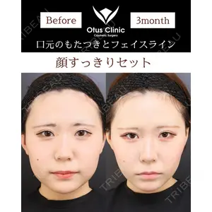 Otus Clinic 【オータスクリニック】 中 徳太郎医師の症例