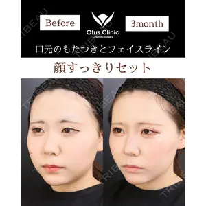Otus Clinic 【オータスクリニック】 中 徳太郎医師の症例