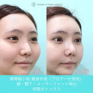 WOM CLINIC GINZA （ワム クリニック ギンザ） 佐々木 和司医師の症例