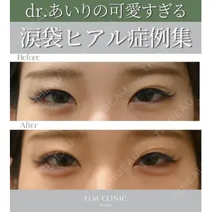 美容皮膚科エルムクリニック 麻布院 横山 歩依里医師の症例
