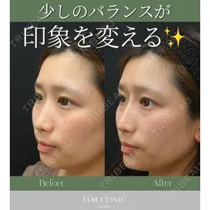 美容皮膚科エルムクリニック 麻布院 横山 歩依里医師の症例