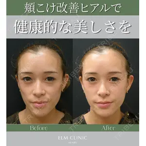美容皮膚科エルムクリニック 麻布院 横山 歩依里医師の症例