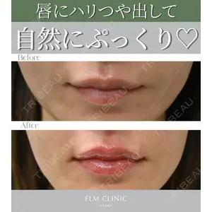 美容皮膚科エルムクリニック 麻布院 横山 歩依里医師の症例