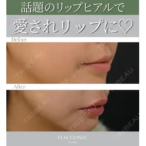 美容皮膚科エルムクリニック 麻布院 横山 歩依里医師の症例