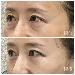 お茶の水美容形成クリニックの症例