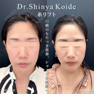 東京シンデレラ美容外科 池袋院の症例