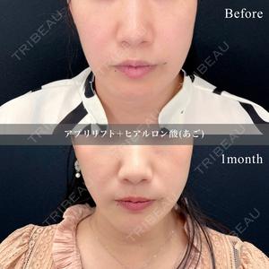 東京シンデレラ美容外科 池袋院の症例