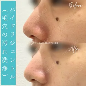 Mavie Beauty Clinic （マヴィービューティークリニック）の症例
