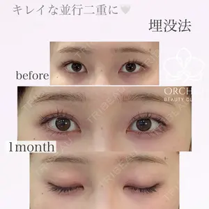 オーキッド美容クリニック東京御徒町 西浦 蘭子医師の症例